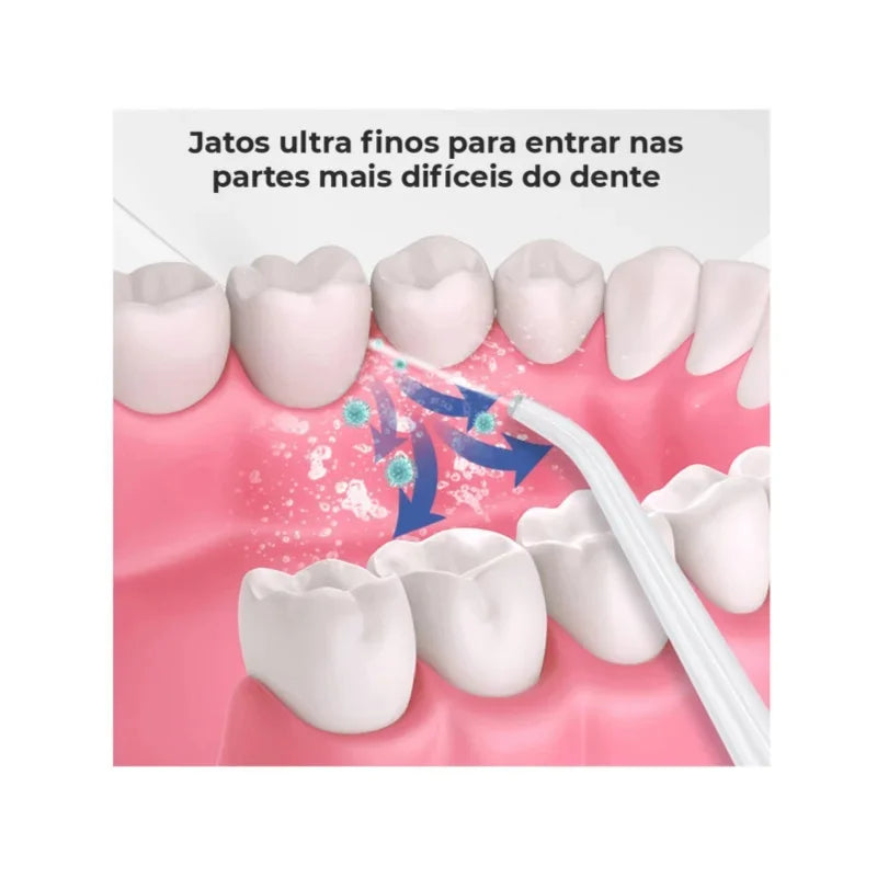 Irrigador Bucal e Removedor de Cálculo Dental - Jet Wire